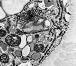 Kính hiển vi điện tử quét SEM với Sinh học cấu trúc