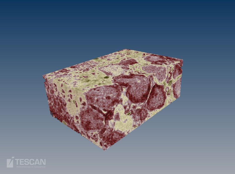 3D reconstruction of retina tissue 3D reconstruction of retina tissue (chụp bằng Kính hiển vi điện tử quét SEM, FIB-SEM TESCAN)