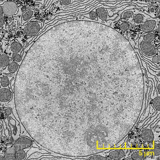 Serial block phase image of a cellnucleus Serial block phase image of a cellnucleus (chụp bằng Kính hiển vi điện tử quét SEM, FIB-SEM TESCAN)