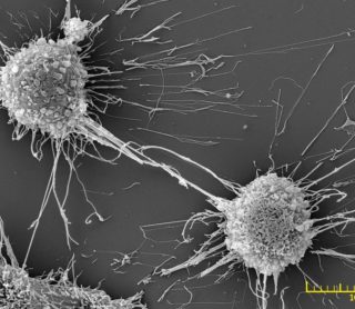 Kính hiển vi điện tử quét SEM trong nghiên cứu Tế bào và Mô