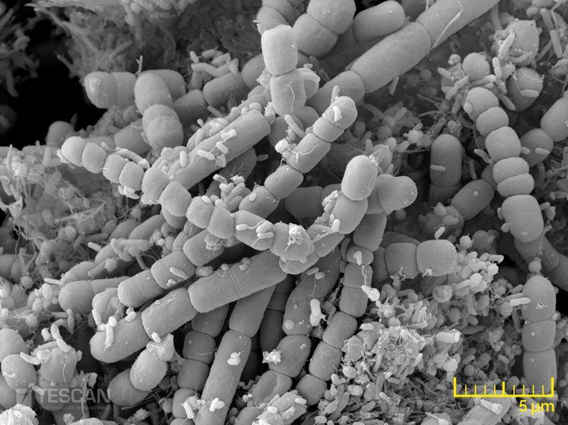 Detail of cyanobacteria species Detail of cyanobacteria species (chụp bởi Kính hiển vi điện tử quét SEM TESCAN)