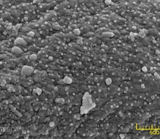 Kính hiển vi điện tử quét SEM trong Kỹ thuật Y sinh