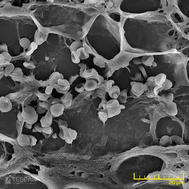 Adipose tissue Adipose tissue