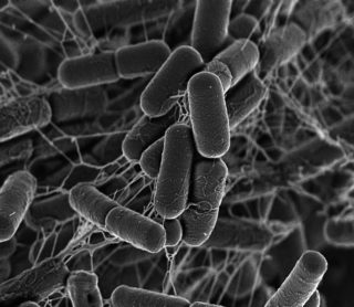 Kính hiển vi điện tử quét SEM trong nghiên cứu Vi sinh vật