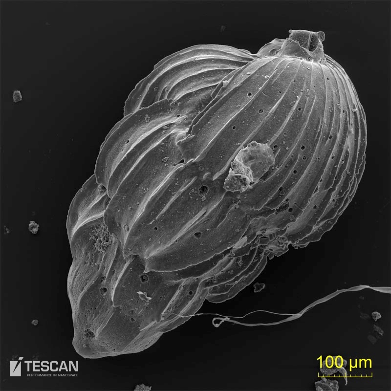 Foraminifera uvigerina